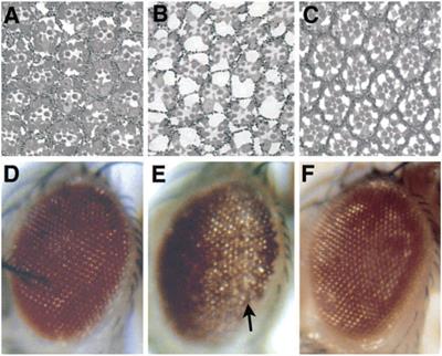 A perspective on Drosophila genetics and its insight into human neurodegenerative disease